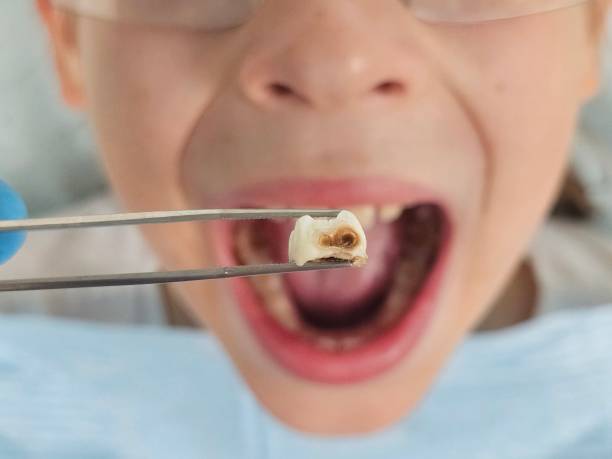 Best Emergency Care for Gum Disease in Marmora, NJ