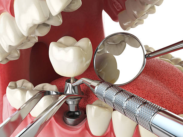 Best Emergency Treatment for Oral Infections in Marmora, NJ